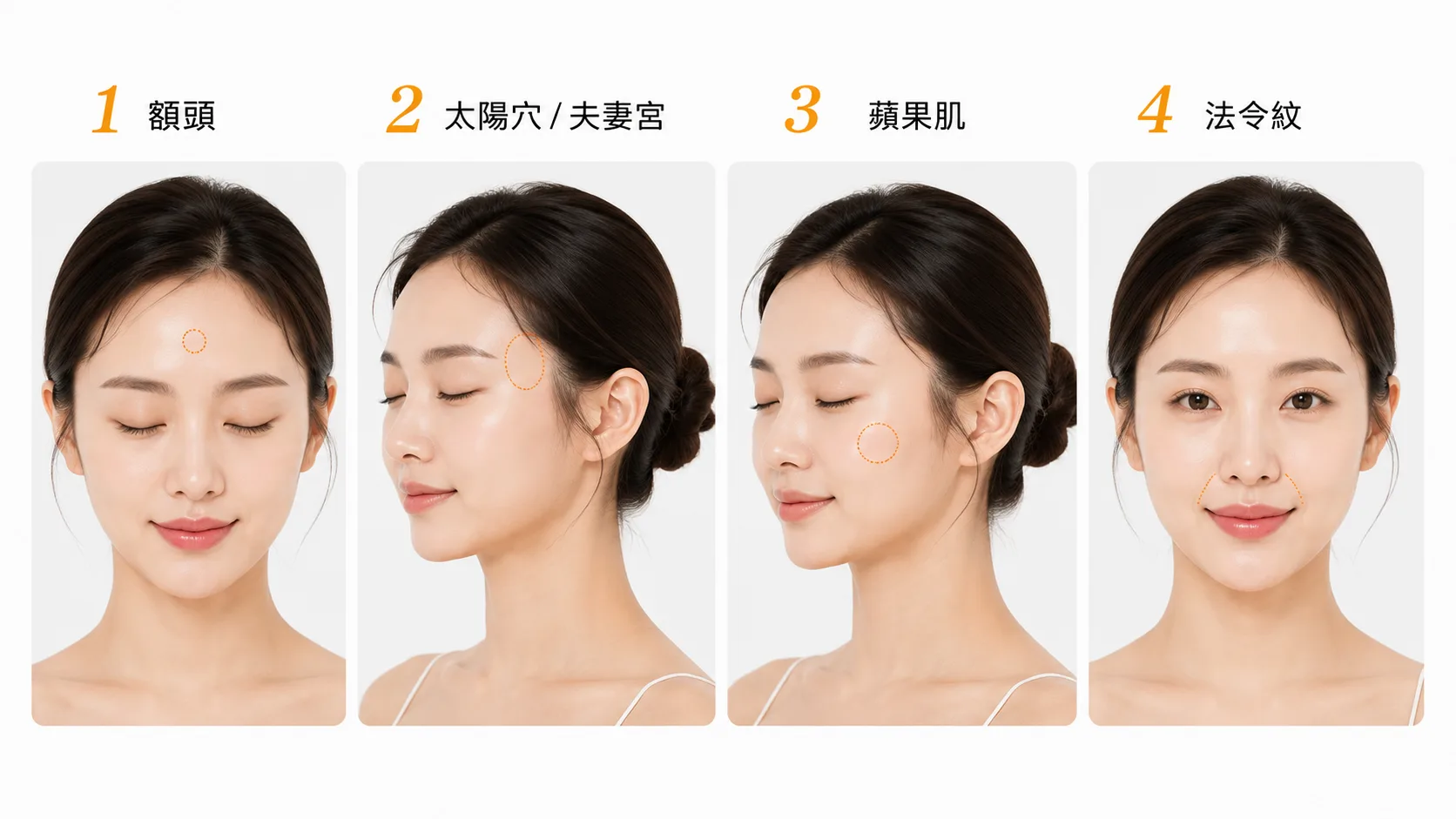 自體脂肪手術方式
